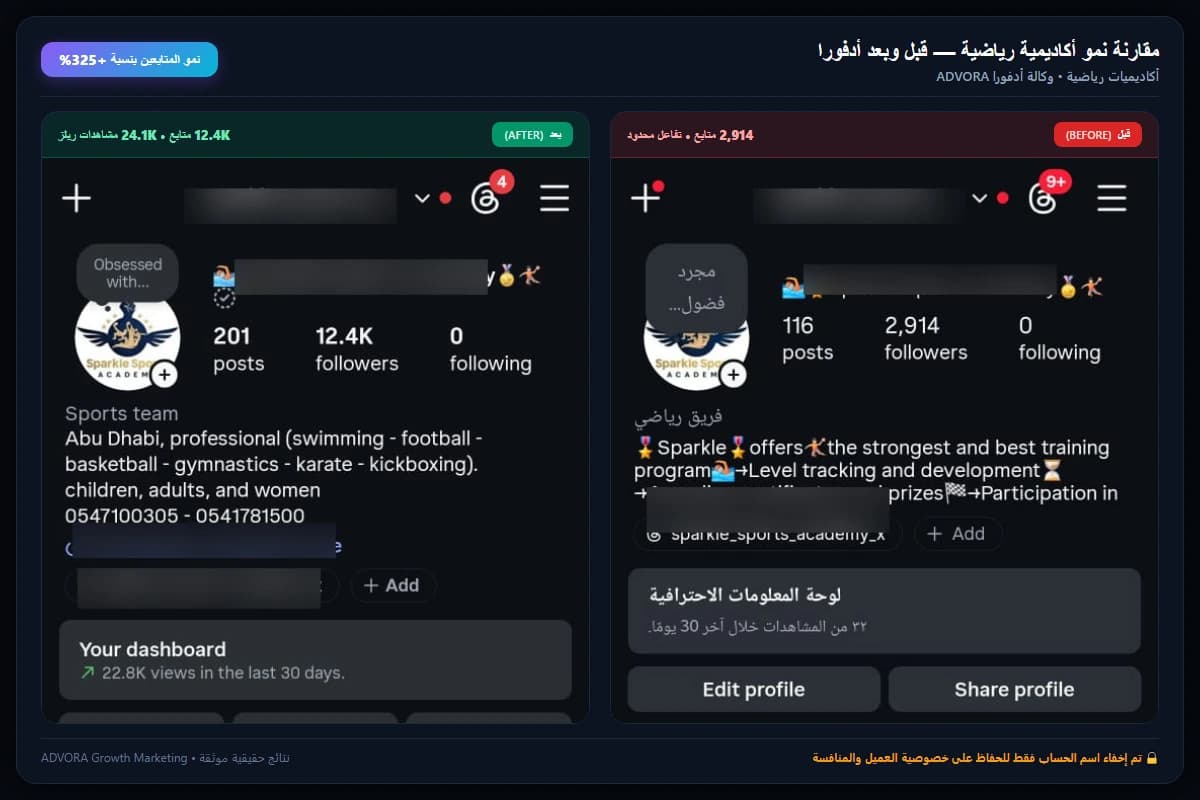 مقارنة نمو أكاديمية رياضية — قبل وبعد أدفورا